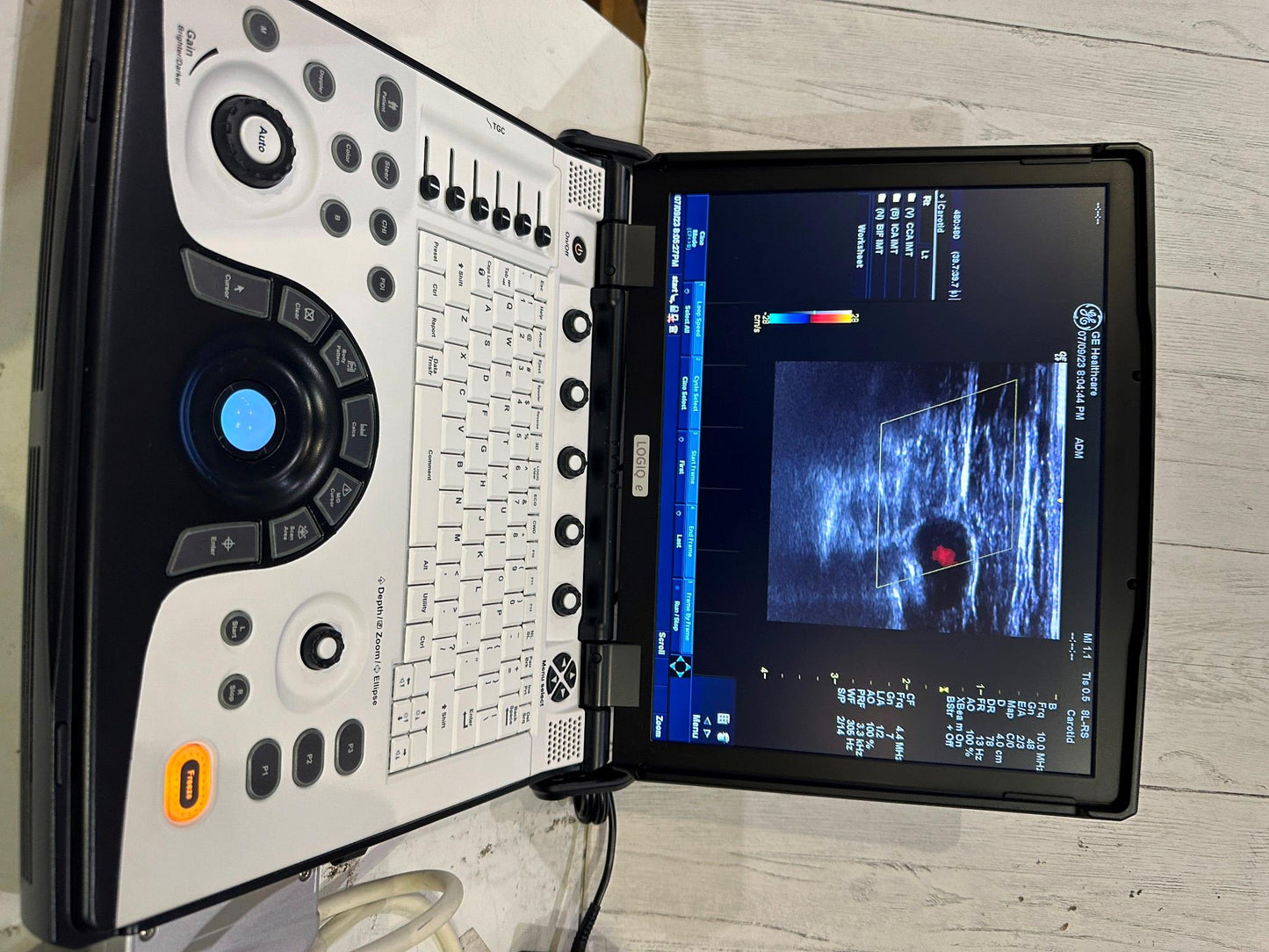 BT12 GE LOGIQ E Next Ge Ultrasound DOM 2016 #