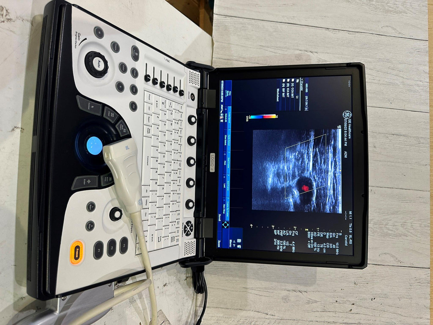 BT12 GE LOGIQ E Next Ge Ultrasound DOM 2016 #