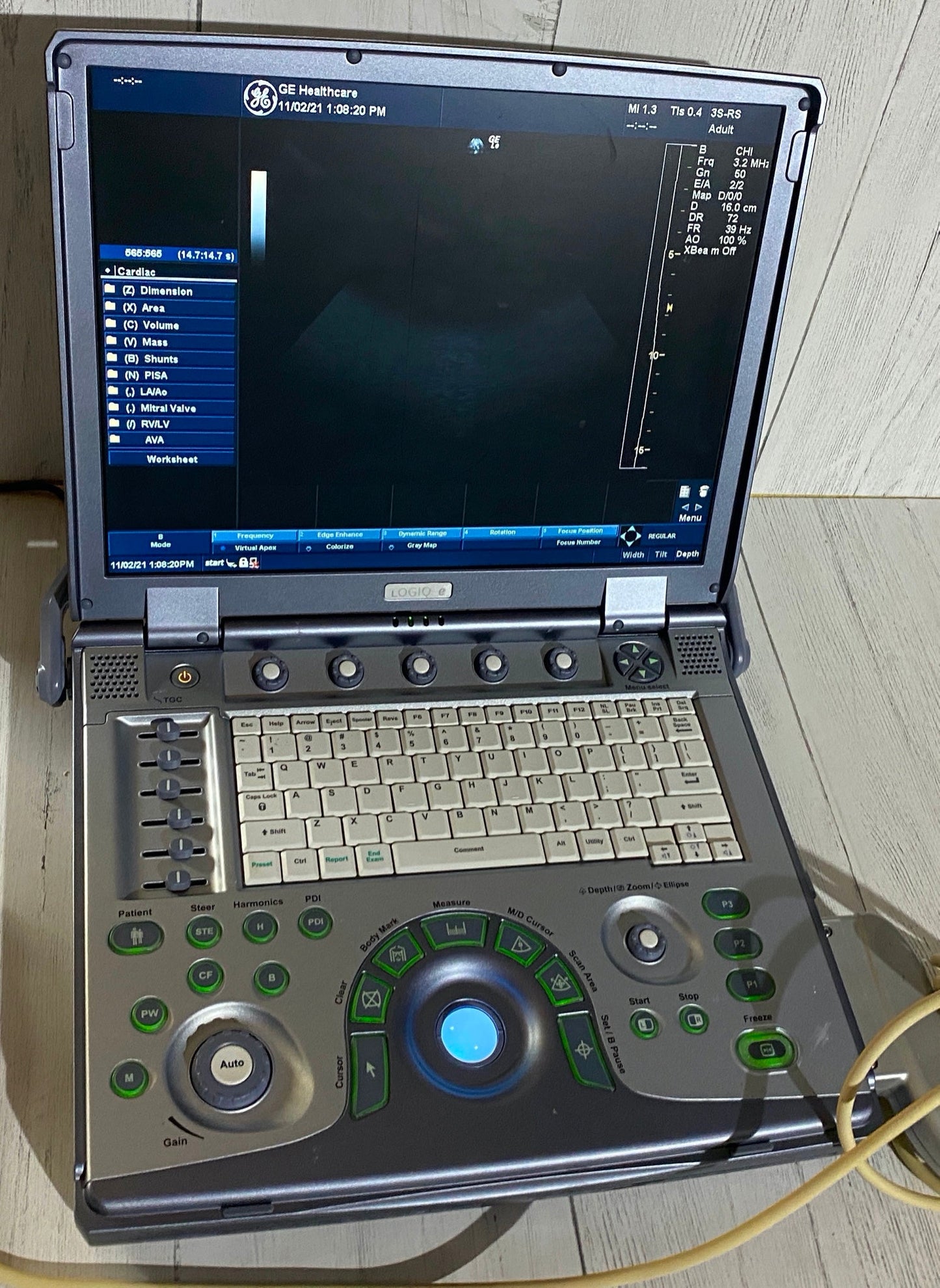 GE Logiq E portable ultrasound Manufactured 2010-No probe #