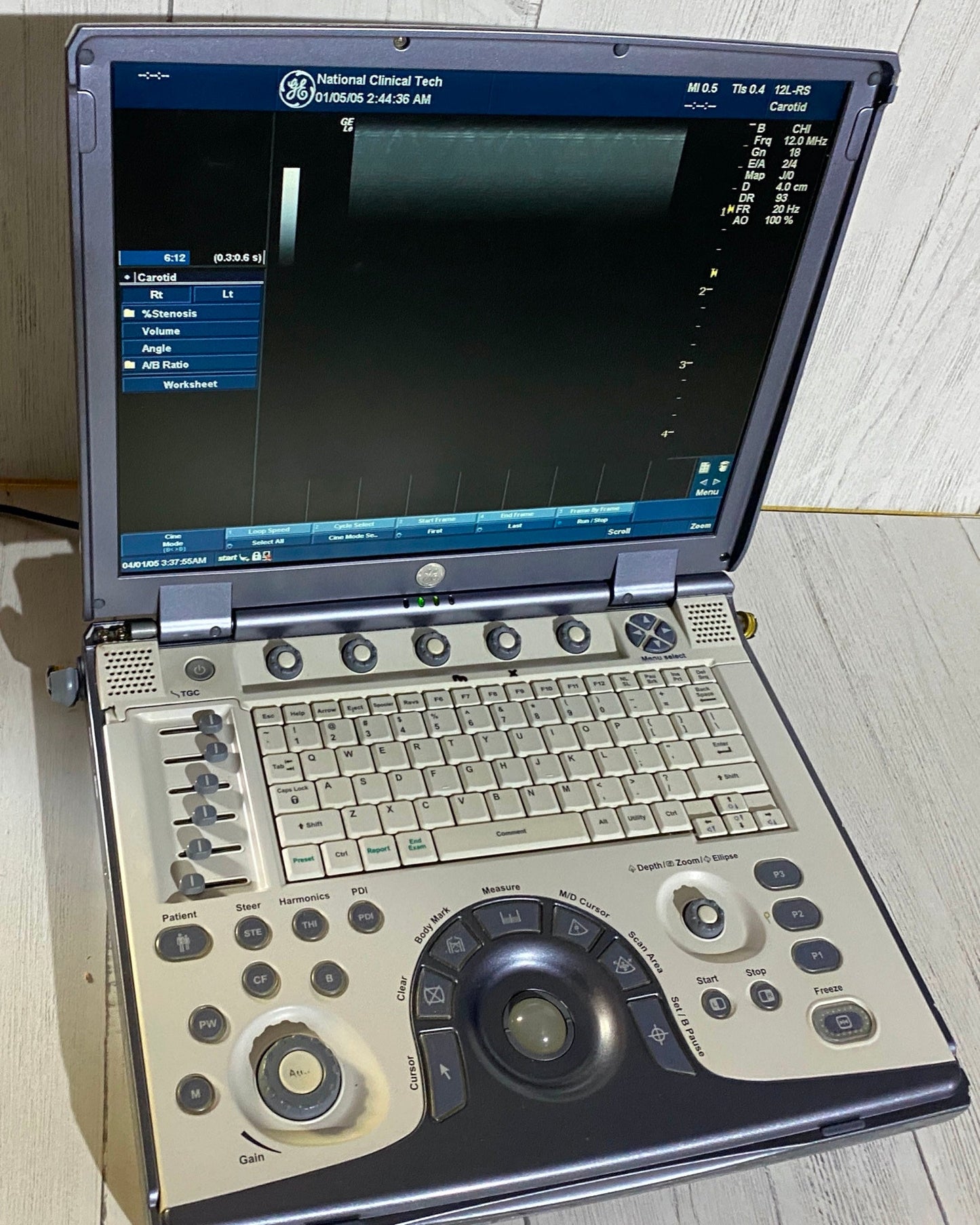 Ge Logic E portable Ultrasound machine with one linear array probe L8-8S #