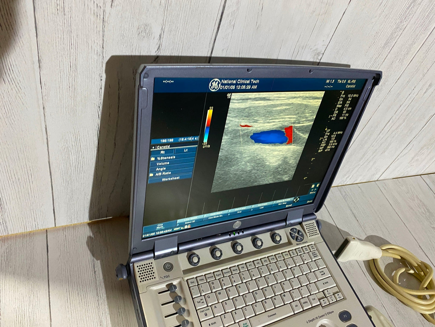 Ge Logic E portable Ultrasound machine with one linear array prone L8-8S -2006 #