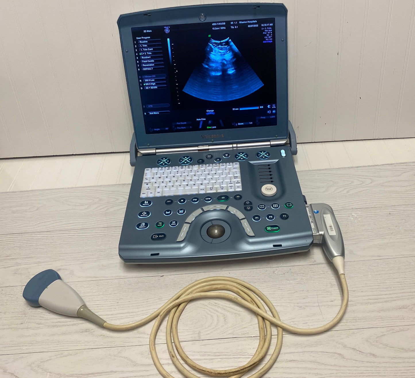 GE VOLUSON E PORTABLE ULTRASOUND MACHINE WITH 1 PROBE (AB2-7-RS) #