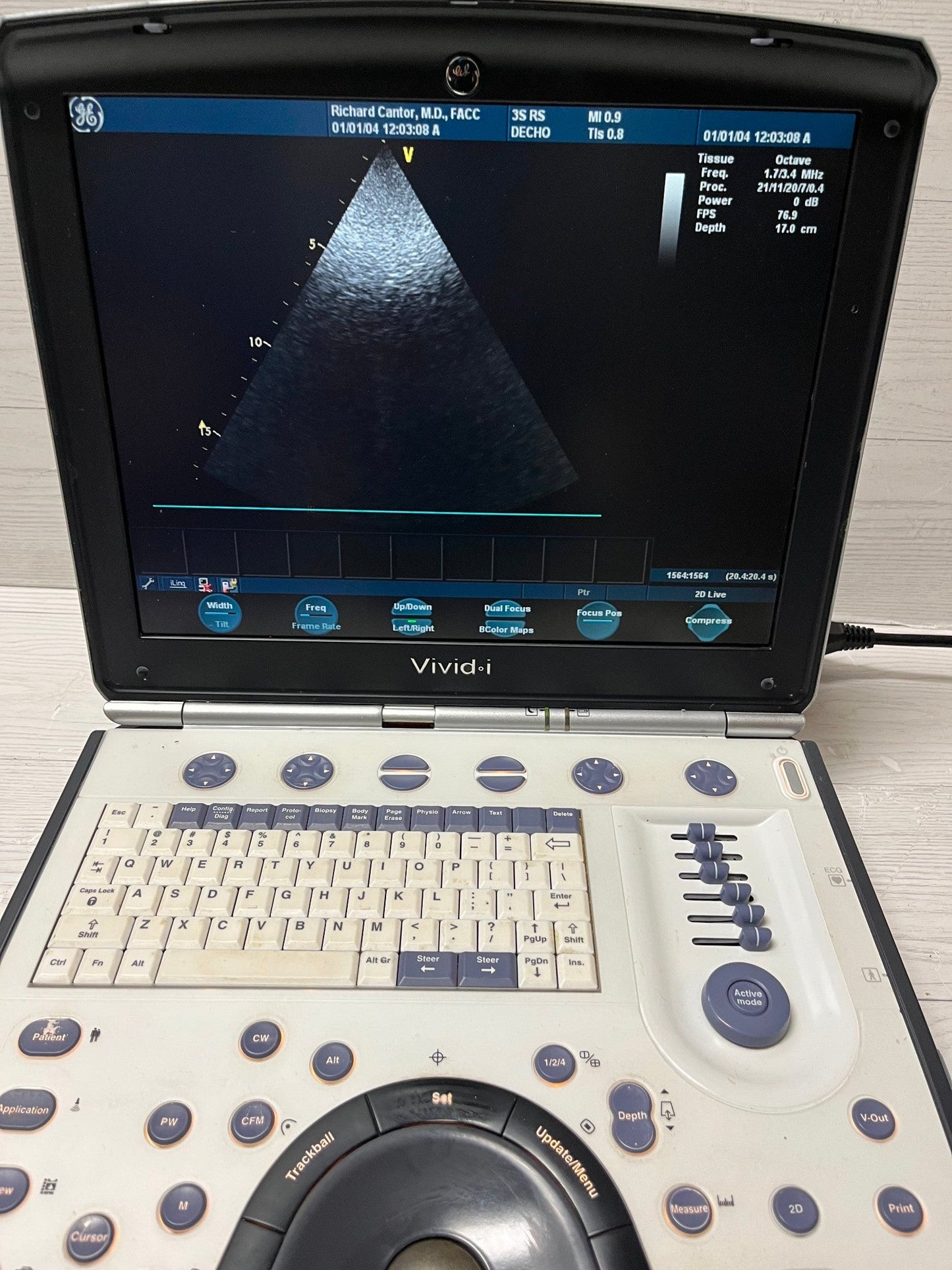 GE Vivid I Color Doppler Ultrasound Scanner, with 3s-RS cardiac & Linear L8-RS #