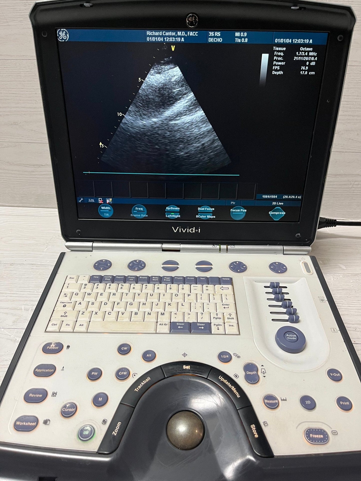GE Vivid I Color Doppler Ultrasound Scanner, with 3s-RS cardiac & Linear L8-RS #