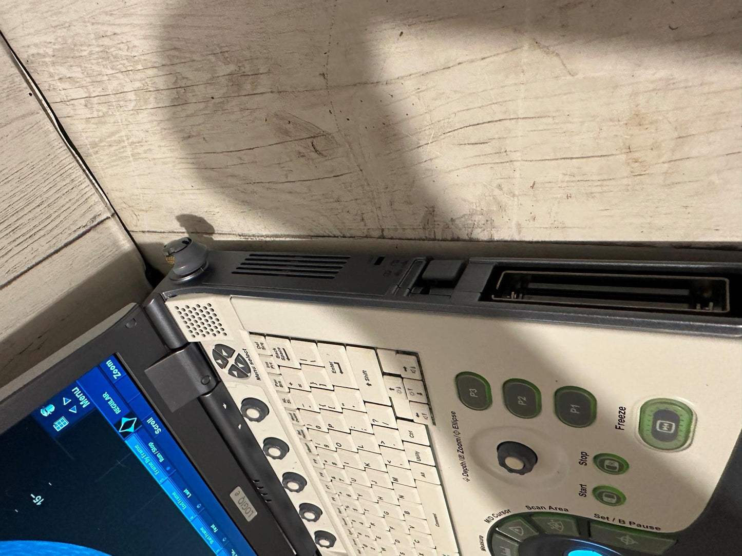 GE LOGIQ E Ultrasound 2006, Vascular, OBGYN, MSK #