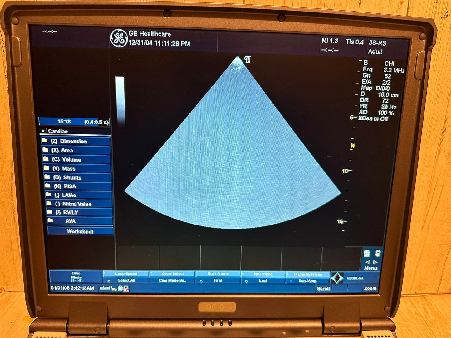 GE LOGIQ E Ultrasound 2006, Vascular, OBGYN, MSK #