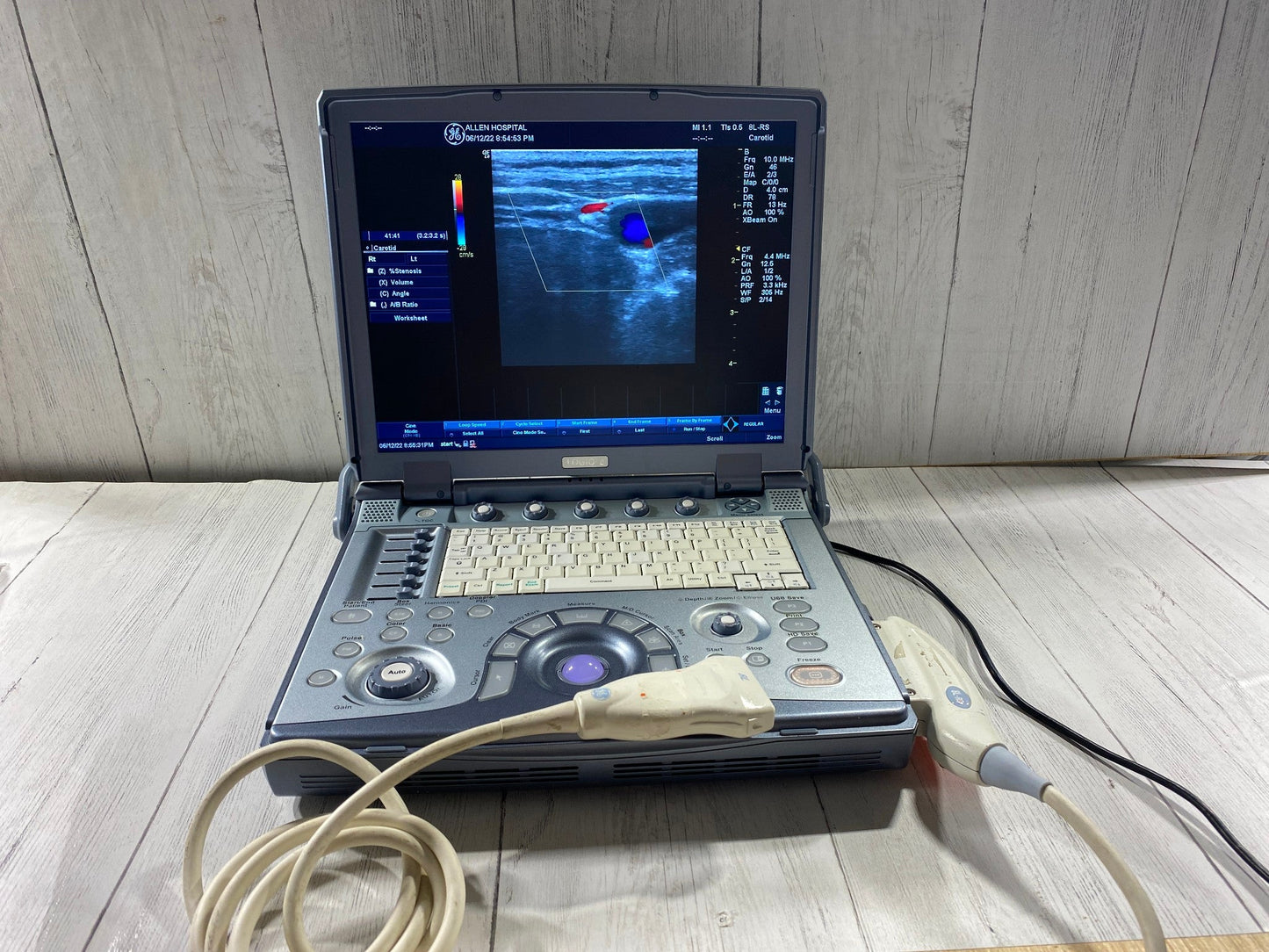 GE LogiQ E portable ultrasound with one linear array probe 8L-RS #
