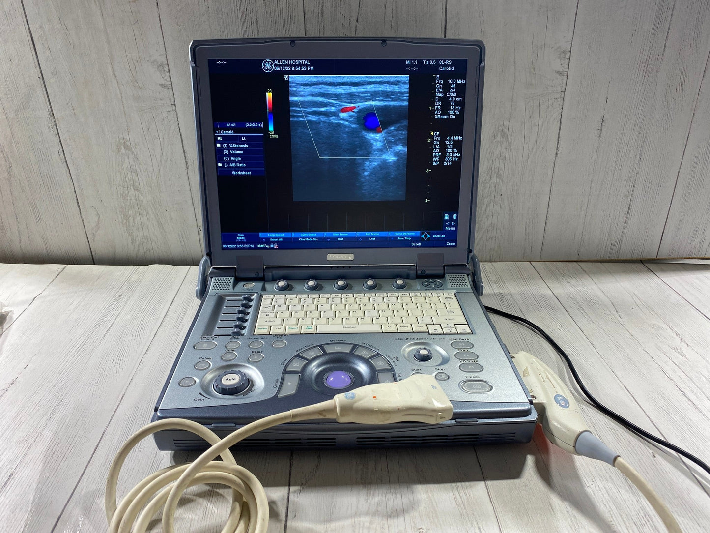 GE LogiQ E portable ultrasound with one linear array probe 8L-RS #