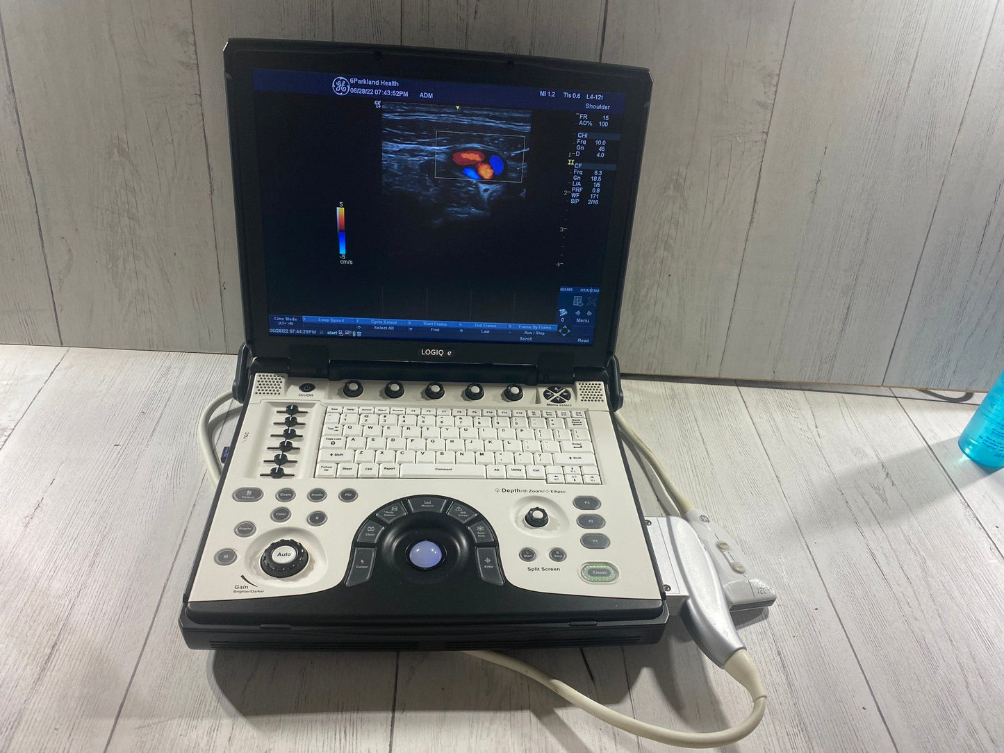 GE LOGIQ E Next Generation Ultrasound Machine & 3S-RS Cardiac Probe BT12 #