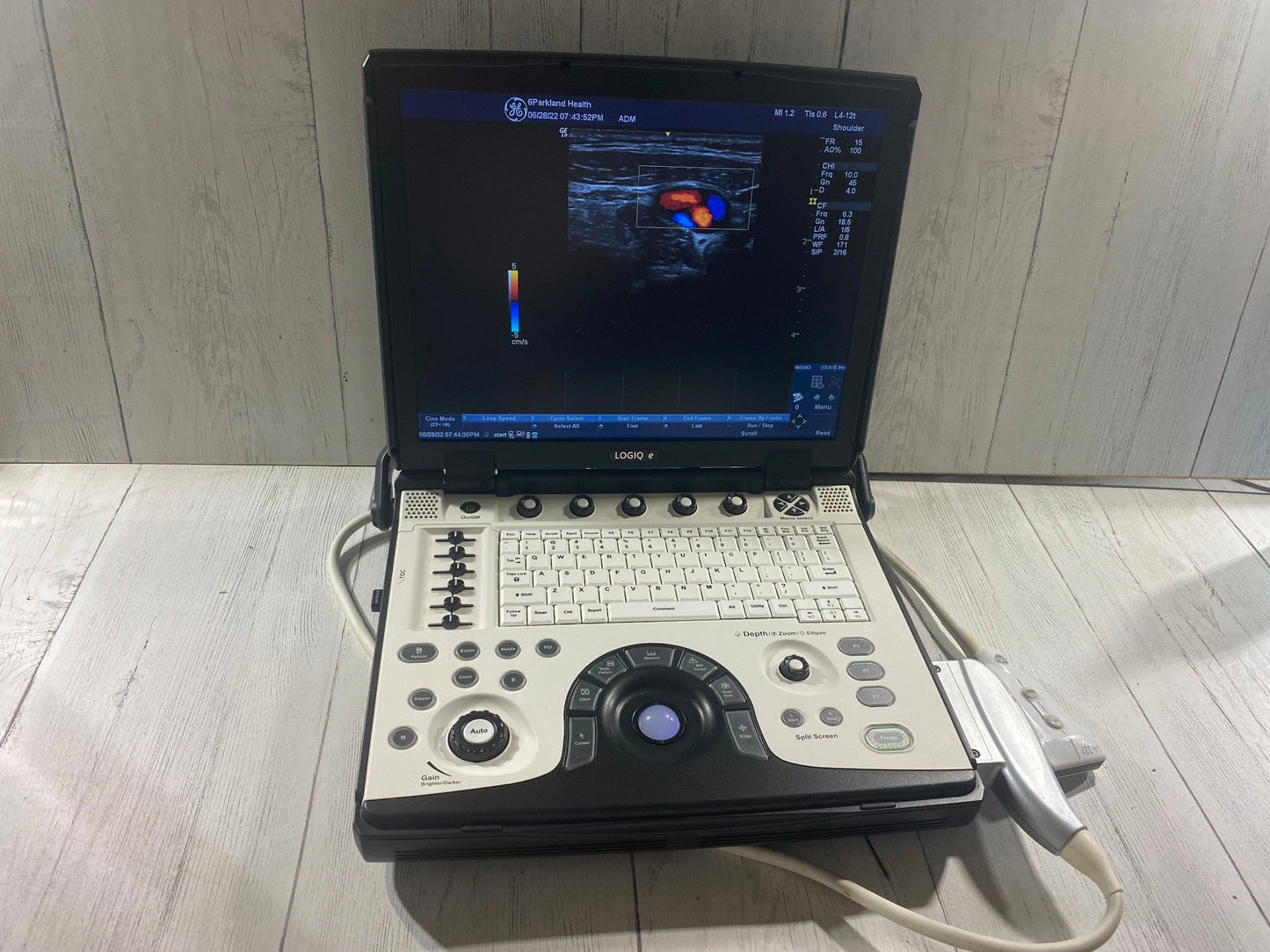 GE LOGIQ E Next Generation Ultrasound Machine & 3S-RS Cardiac Probe BT12 #