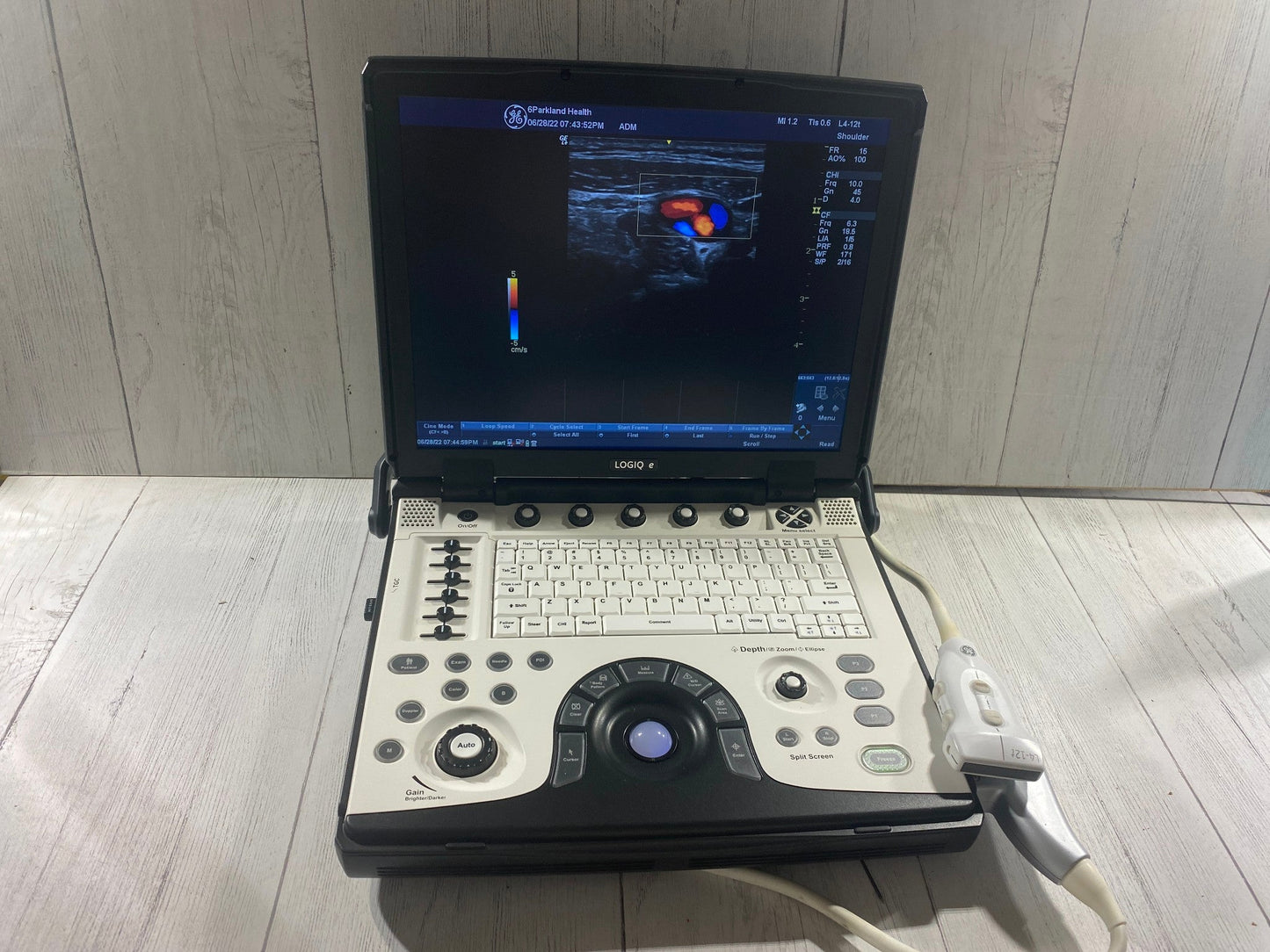 GE LOGIQ E Next Generation Ultrasound Machine & 3S-RS Cardiac Probe BT12 #