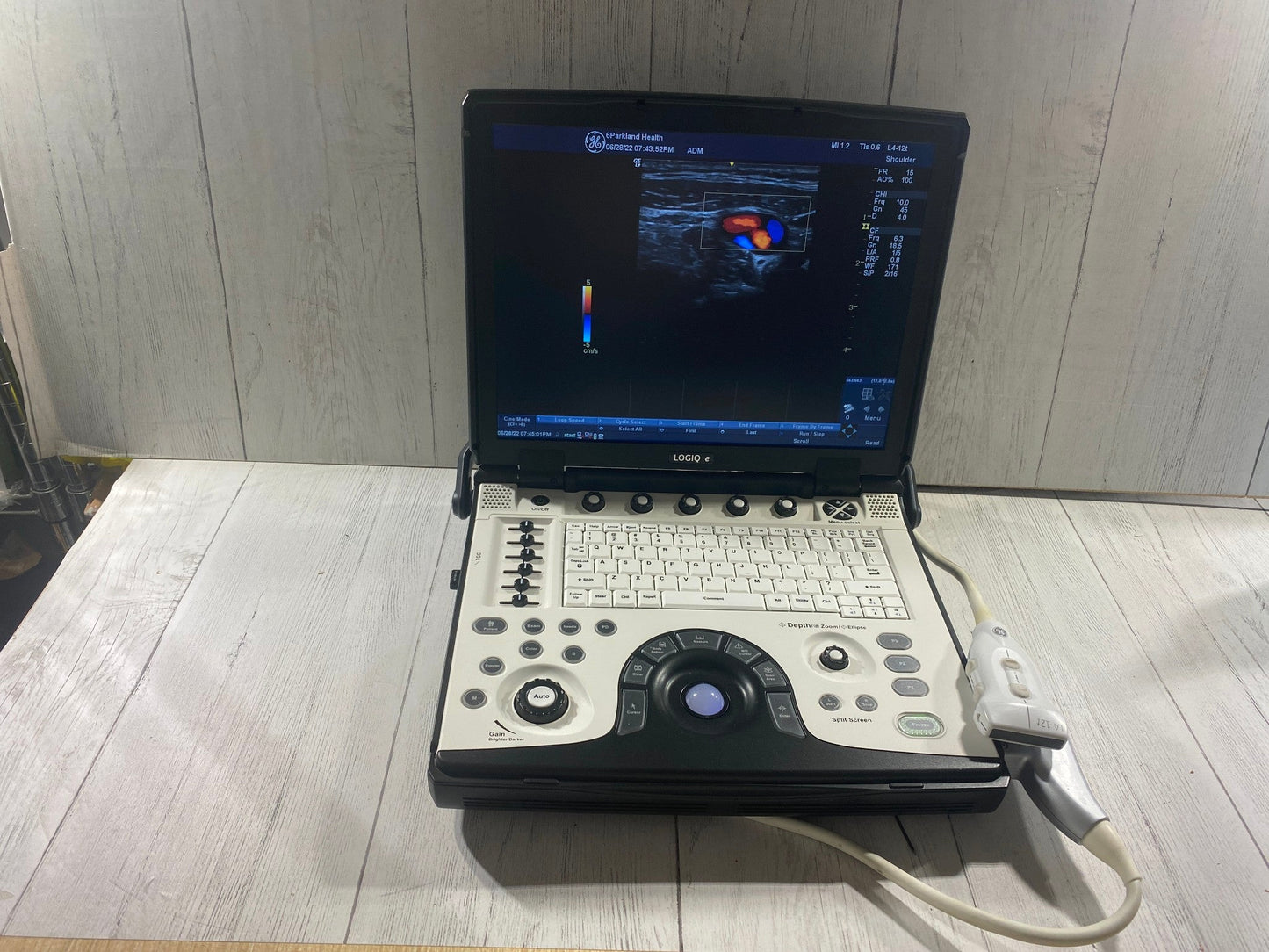 GE LOGIQ E Next Generation Ultrasound Machine & 3S-RS Cardiac Probe BT12 #