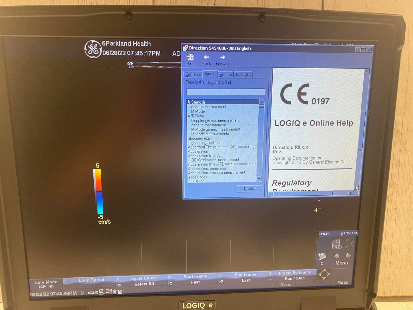 GE LOGIQ E Next Generation Ultrasound Machine & 3S-RS Cardiac Probe BT12 #