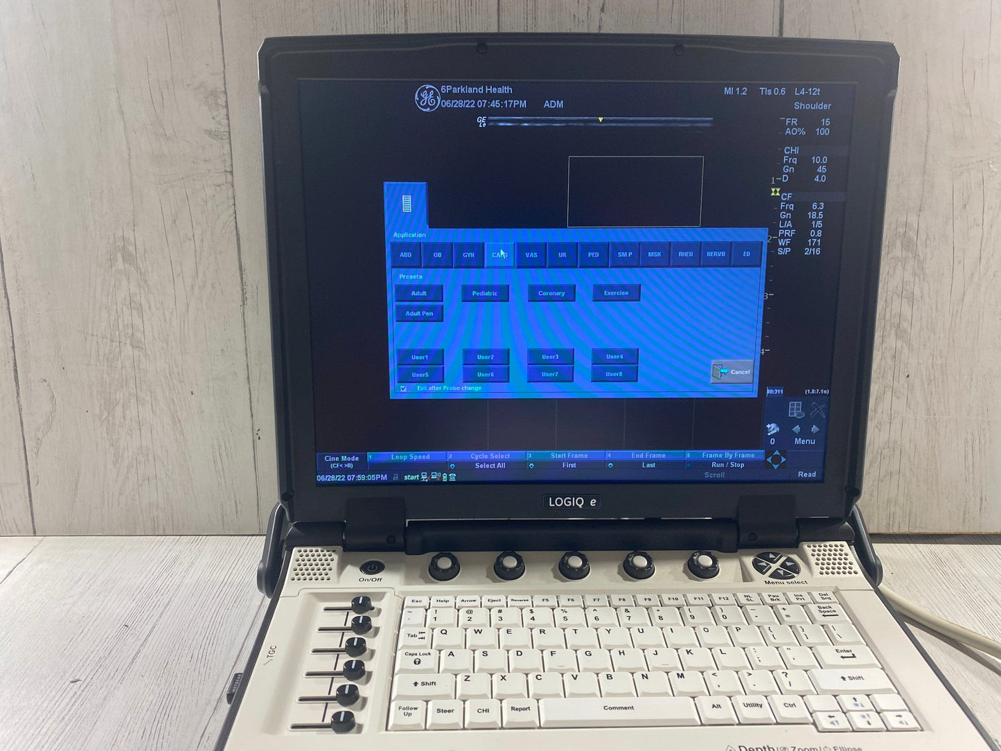 GE LOGIQ E Next Generation Ultrasound Machine & 3S-RS Cardiac Probe BT12 #