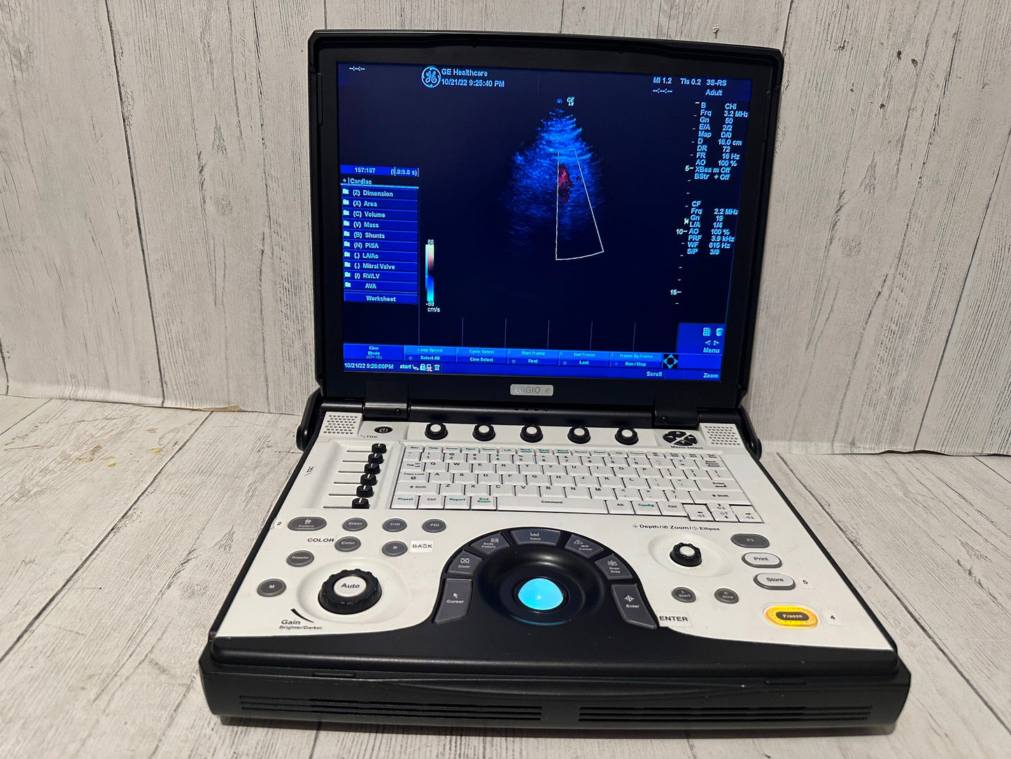 GE LOGIQ E Next Generation Ultrasound BT12 DOM 2012 #