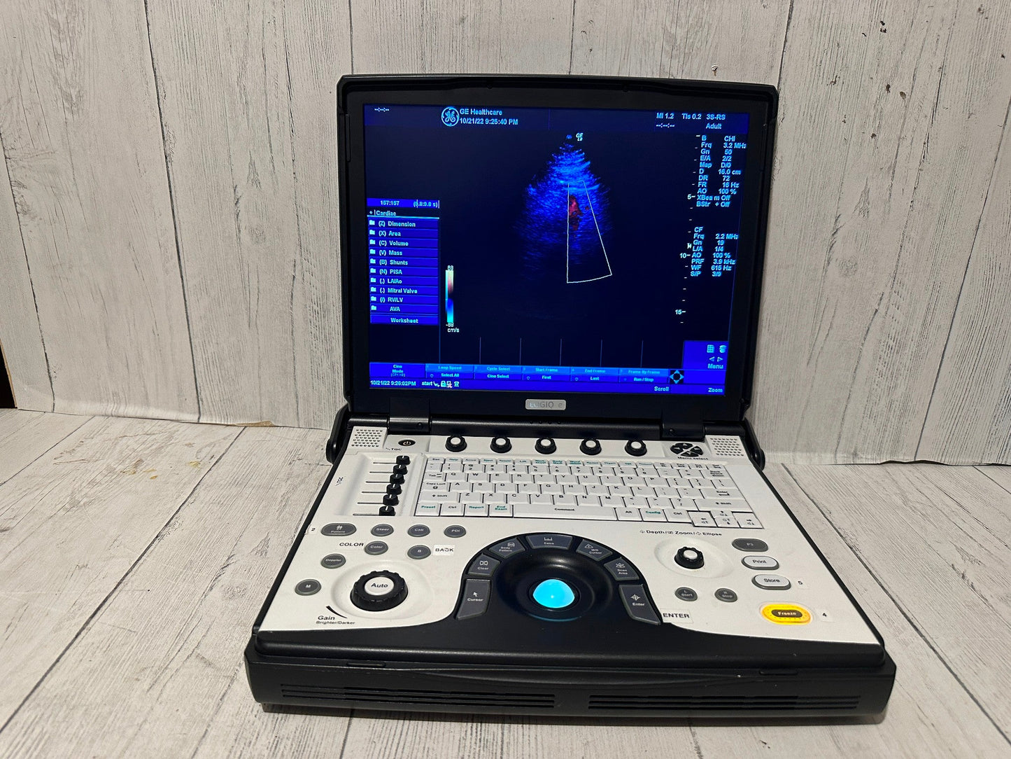 GE LOGIQ E Next Generation Ultrasound BT12 DOM 2012 #