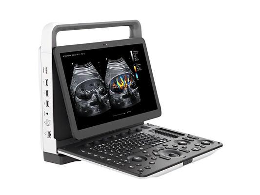 How to Choose the Right Ultrasound System for Your Medical Facility