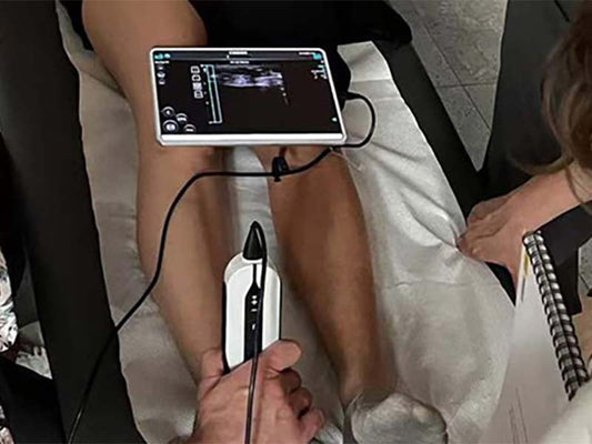 Handheld ultrasound device used in plastic surgery workflows