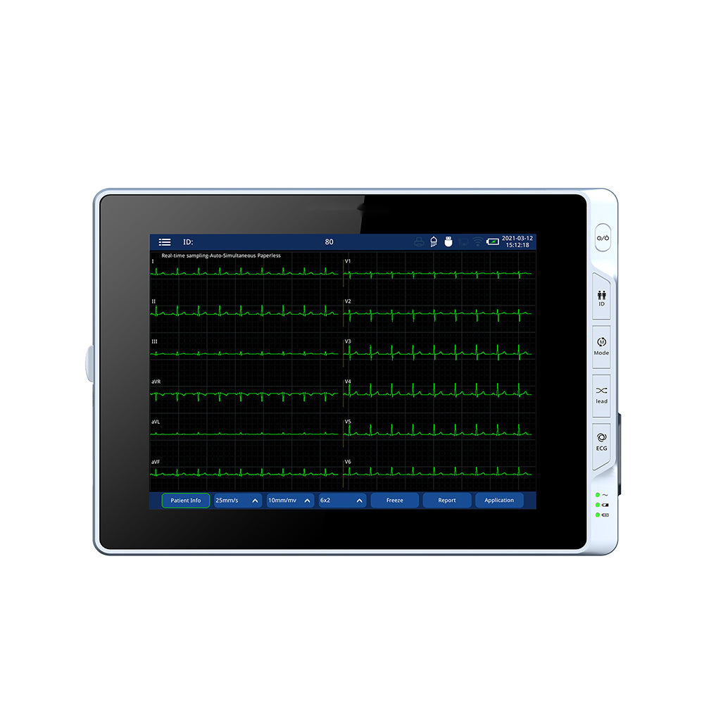 Electrocardiograph EKG Machine Digital Mobile 6 Channel ECG Machine #