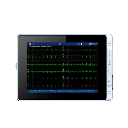 Electrocardiograph EKG Machine Digital Mobile 6 Channel ECG Machine #