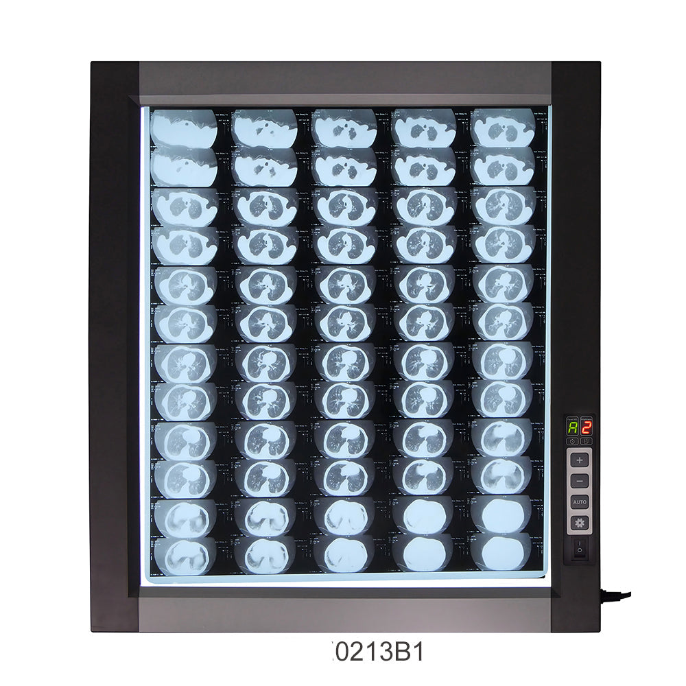 LED X-Ray Imaging Film Viewer Sidelight Mode X-Ray Film Viewer #