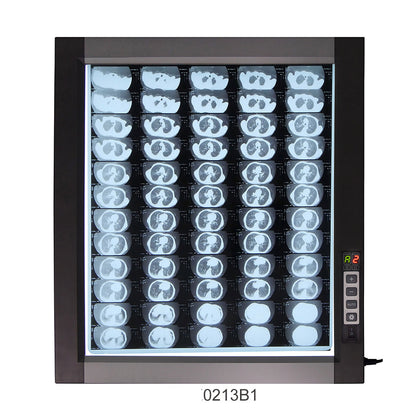 LED X-Ray Imaging Film Viewer Sidelight Mode X-Ray Film Viewer #