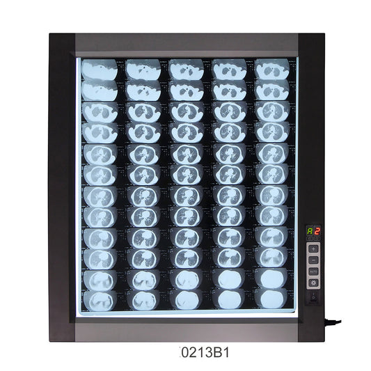 LED X-Ray Imaging Film Viewer Sidelight Mode X-Ray Film Viewer #