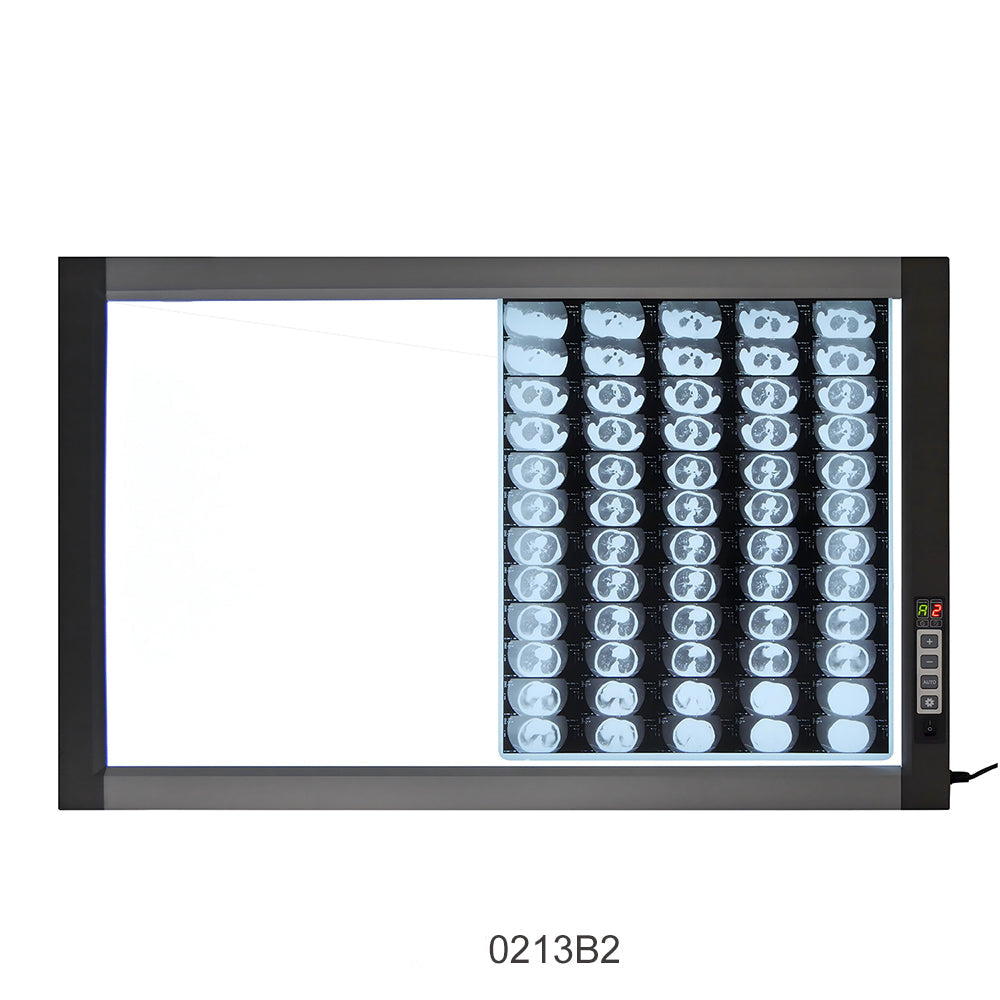 LED X-Ray Imaging Film Viewer Sidelight Mode X-Ray Film Viewer #
