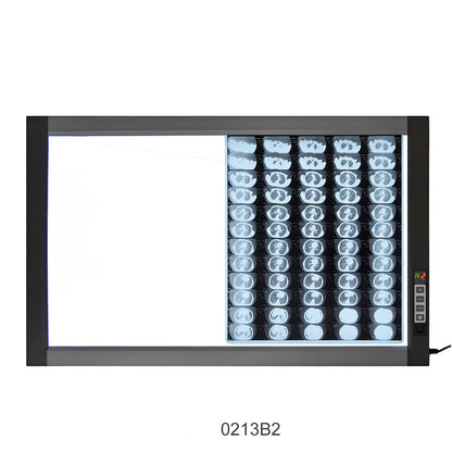 LED X-Ray Imaging Film Viewer Sidelight Mode X-Ray Film Viewer #