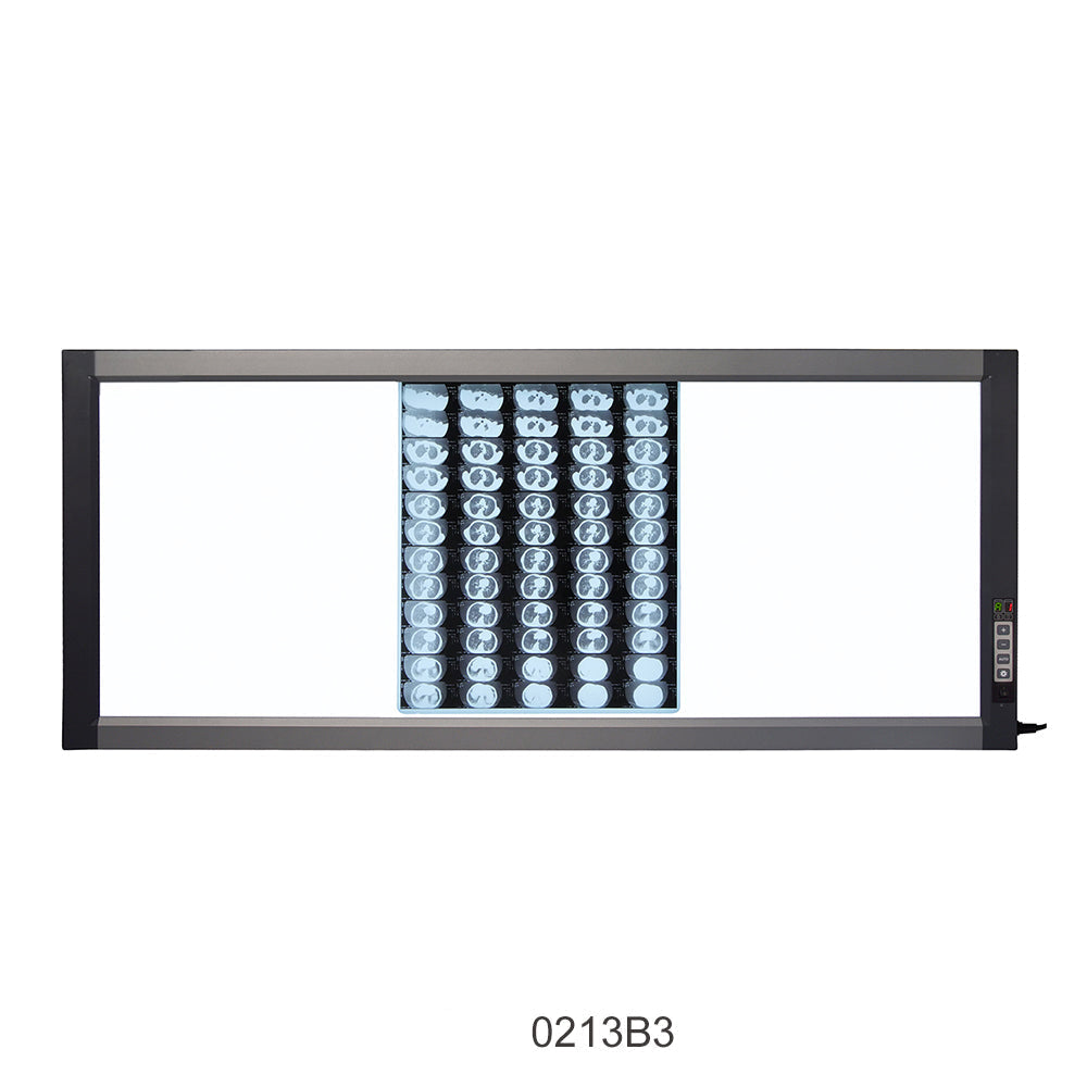 LED X-Ray Imaging Film Viewer Sidelight Mode X-Ray Film Viewer #