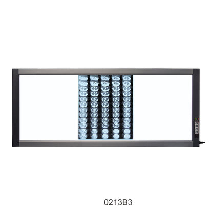 LED X-Ray Imaging Film Viewer Sidelight Mode X-Ray Film Viewer #