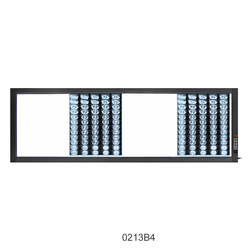 LED X-Ray Imaging Film Viewer Sidelight Mode X-Ray Film Viewer #
