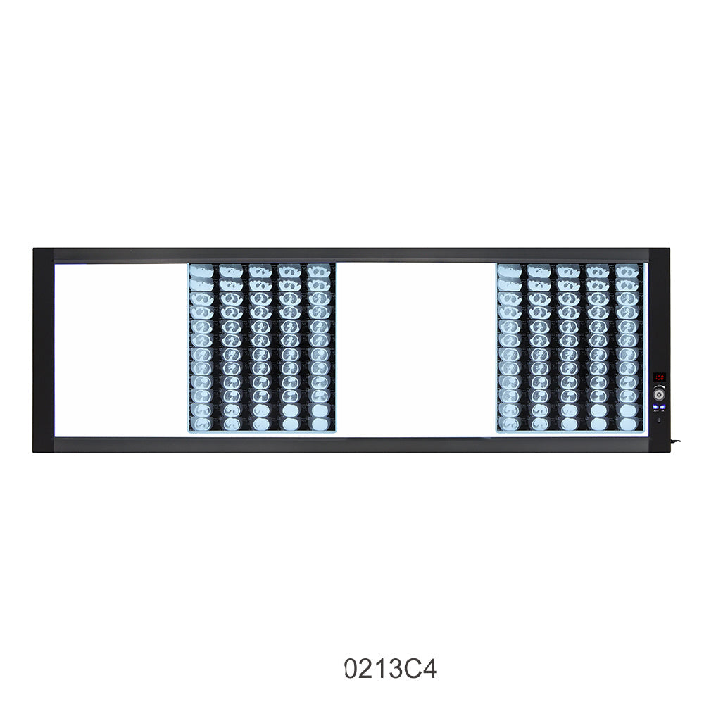 Medical Blue Film Viewer LED Medical Film Light X Ray Viewer #