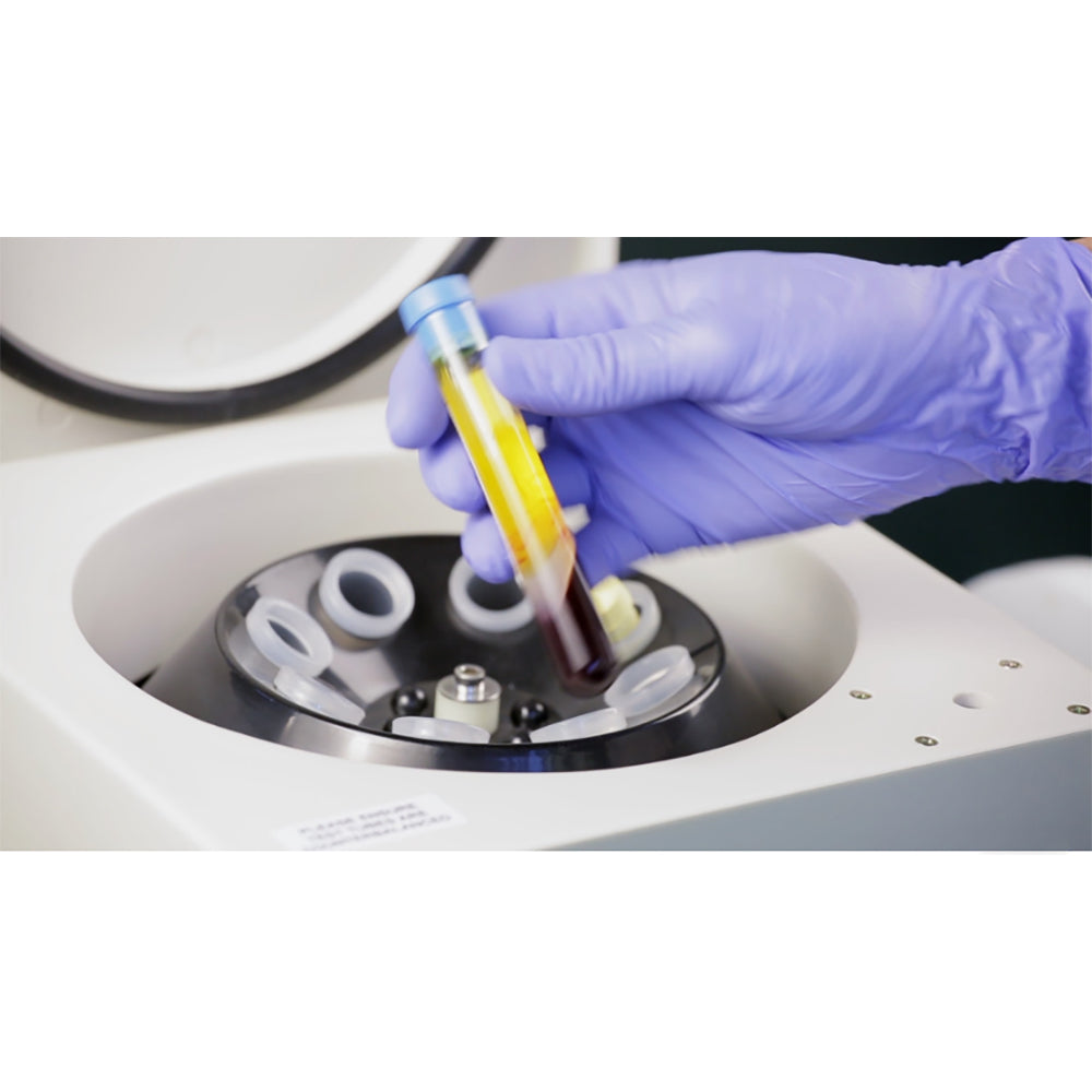 In Stock Centrifuge PRP PRF Centrifuge Beauty 4000rpm Low Speed Centrifuge #