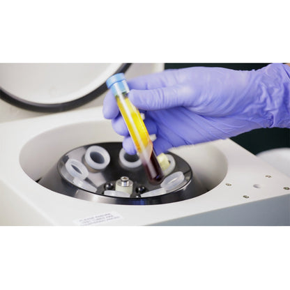 In Stock Centrifuge PRP PRF Centrifuge Beauty 4000rpm Low Speed Centrifuge #