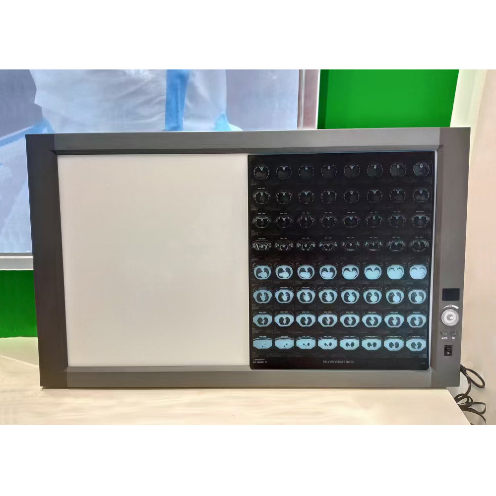 X-Ray Film Viewer UItra-Bright LED Back Light Mode X-Ray Film Viewer #