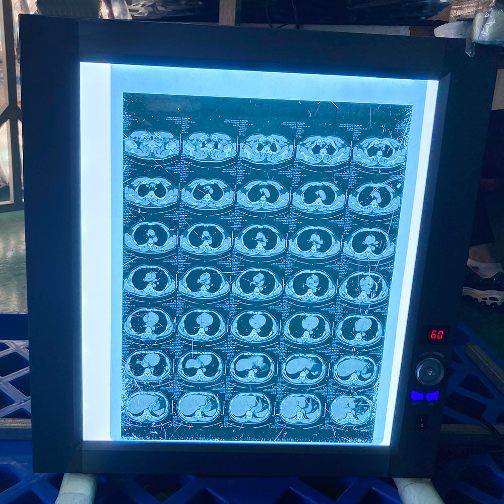 Medical Blue Film Viewer LED Medical Film Light X Ray Viewer #