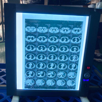 Medical Blue Film Viewer LED Medical Film Light X Ray Viewer #