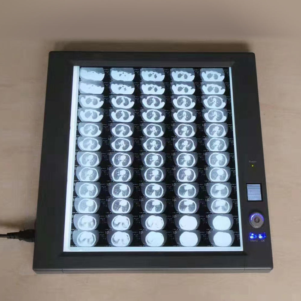 X-Ray Film Viewer UItra-Bright LED Back Light Mode X-Ray Film Viewer #