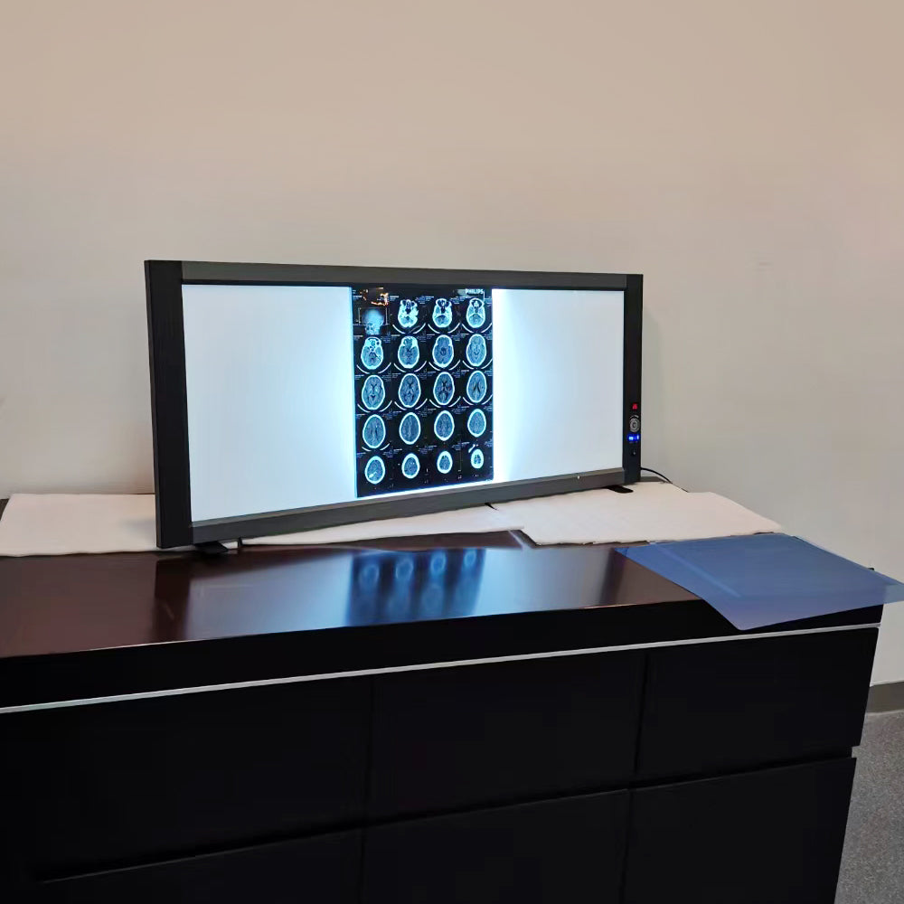 X-Ray Film Viewer UItra-Bright LED Back Light Mode X-Ray Film Viewer #