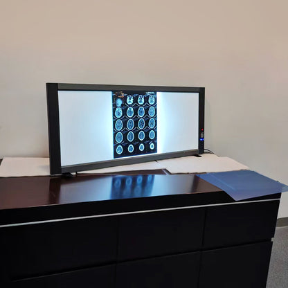 X-Ray Film Viewer UItra-Bright LED Back Light Mode X-Ray Film Viewer #