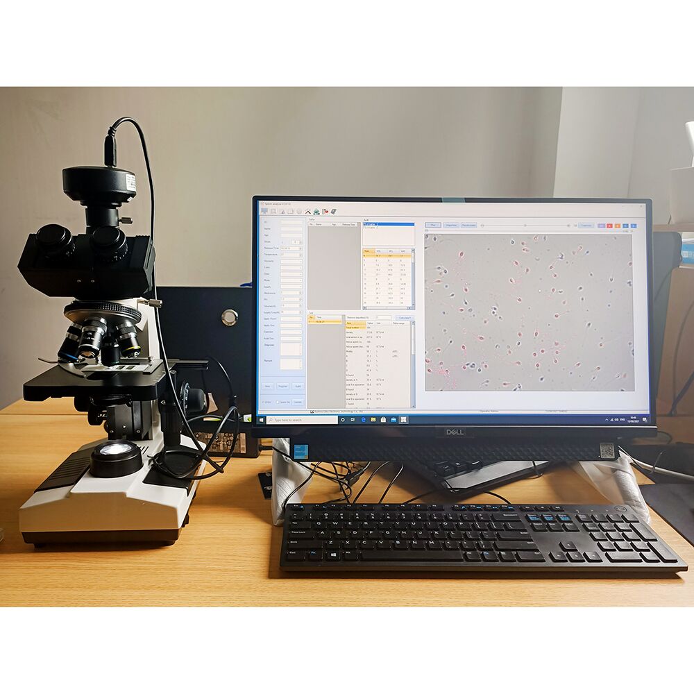 Semen Analysis Machine Microscope Sperm Quality Analyzer #