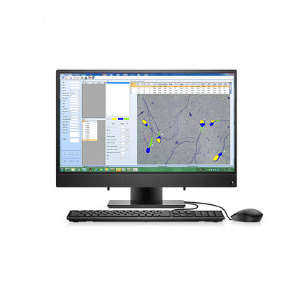 Semen Analyser Portable Laptop Semen Analysis Sperm Analyzer #