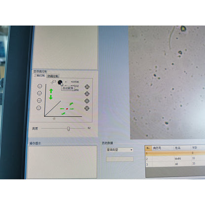 Fully Automatic Semen Analyzer Sperm Quality Analyzer #