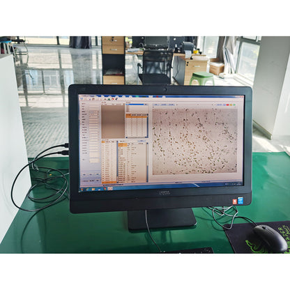 Fully Automatic Semen Analyzer Sperm Quality Analyzer #