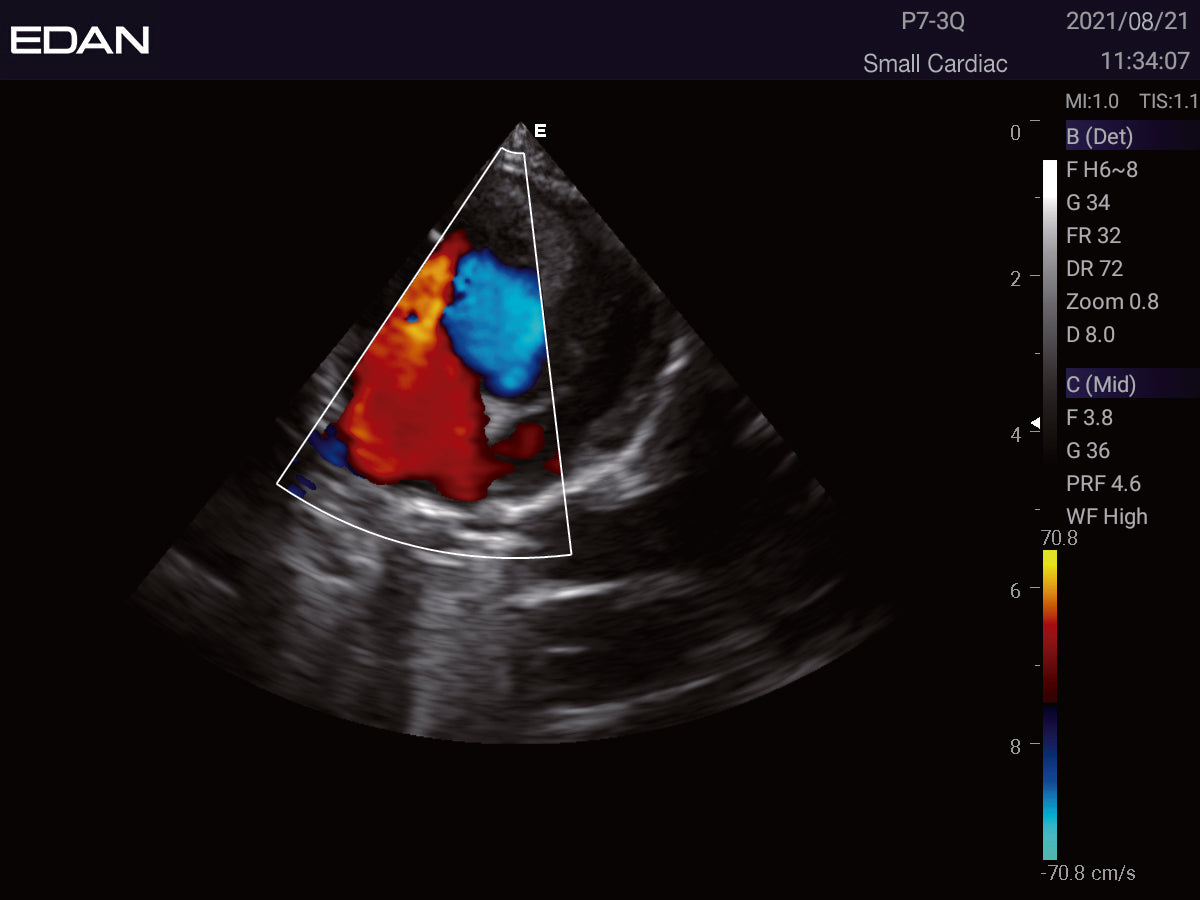EDAN Acclarix LX3 Vet Ultrasound System