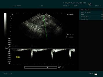 EDAN DUS 60 Vet Ultrasound System