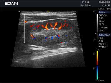EDAN Acclarix AX2 Vet Ultrasound System