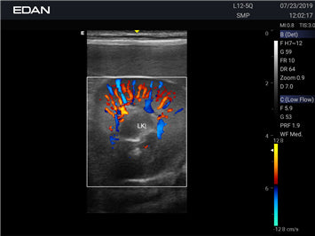 EDAN Acclarix AX2 Vet Ultrasound System