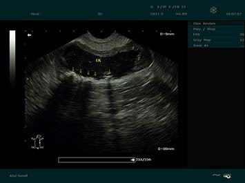 EDAN DUS 60 Vet Ultrasound System